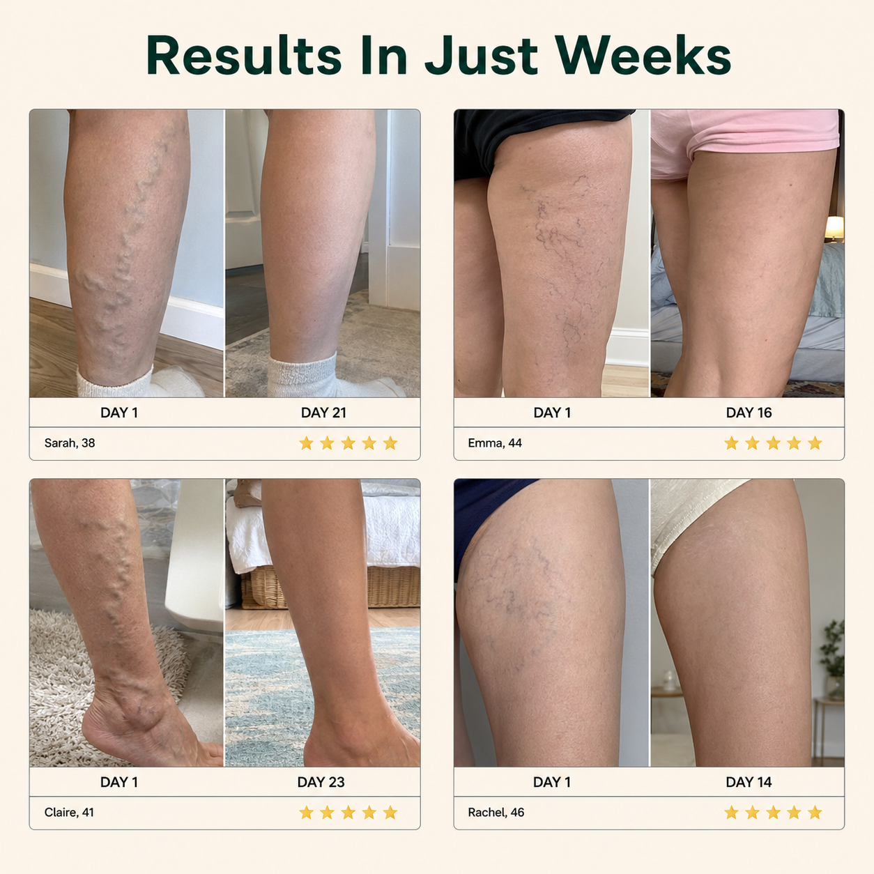 Flatten Varicose Veins Within 16 days or less - 12x Per Box