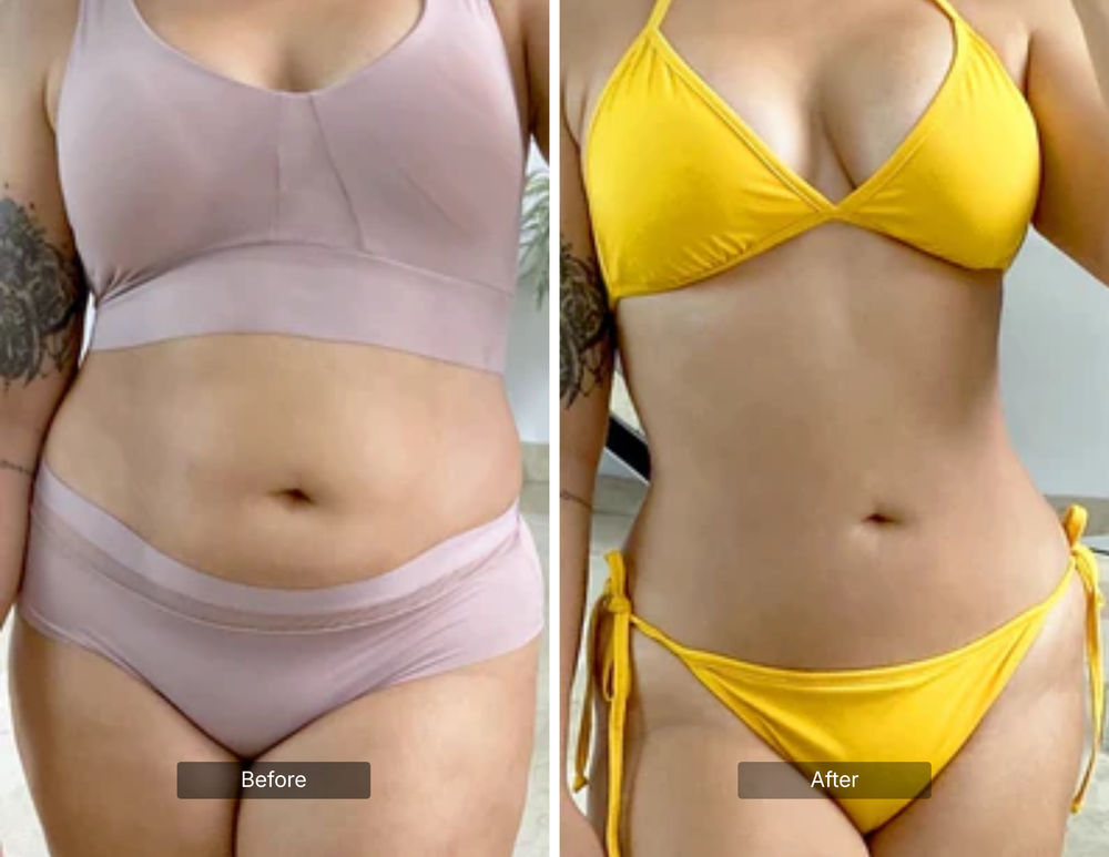 BODY SCULPTING