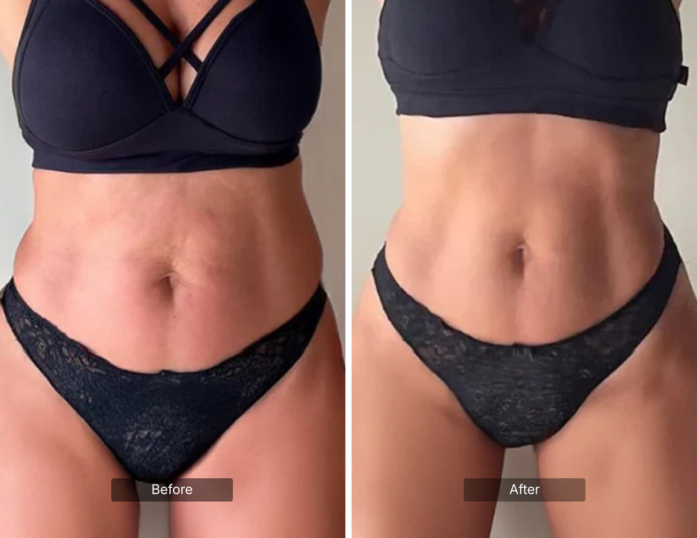 SKIN FIRMING